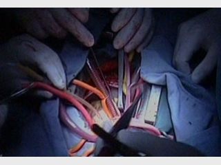 ����������� ��� ����� �������� ���� ���������� 