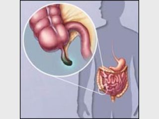 � ������ ������� ������� ���������� ����� ���