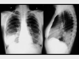 ����� ����� ������� ������ � �����������