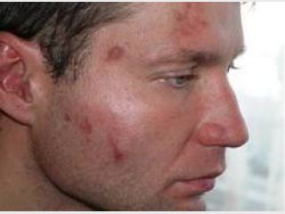 �������� �������� ���������� ��-��� ������ 